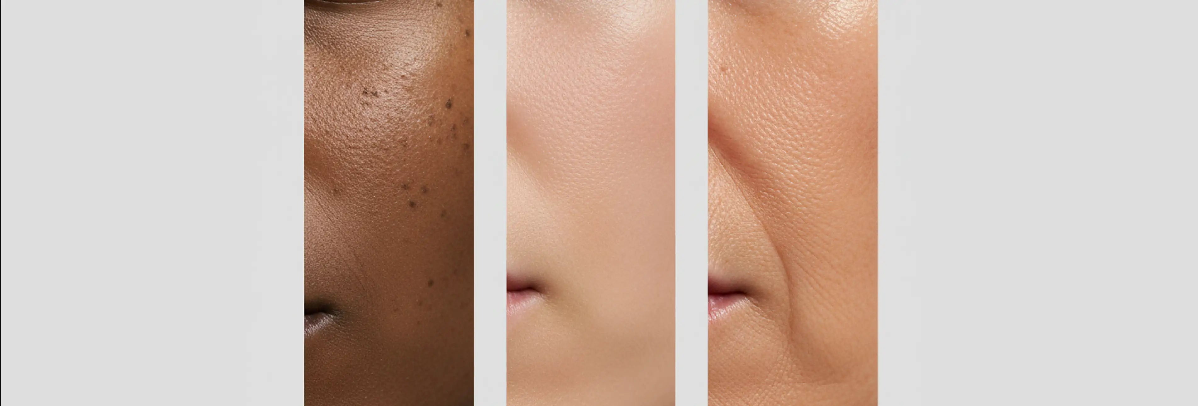 Anyra Cosmetics Speaking Skin Not Stereotypes