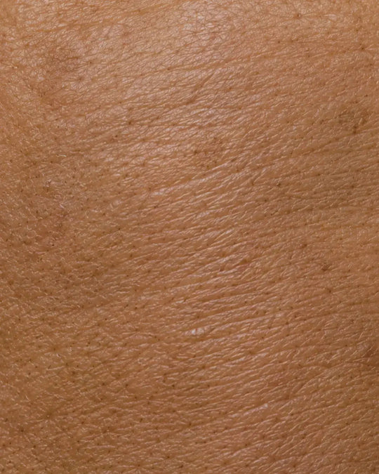 Anti-Aging