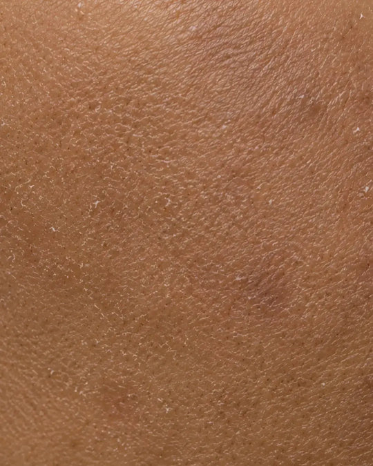 Rough Texture / Tan / Dead Skin