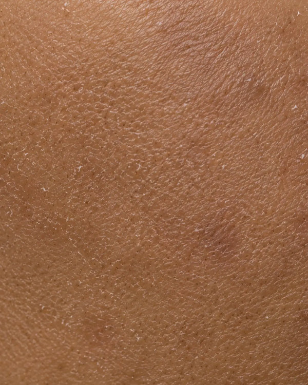 Tan & Dead Skin